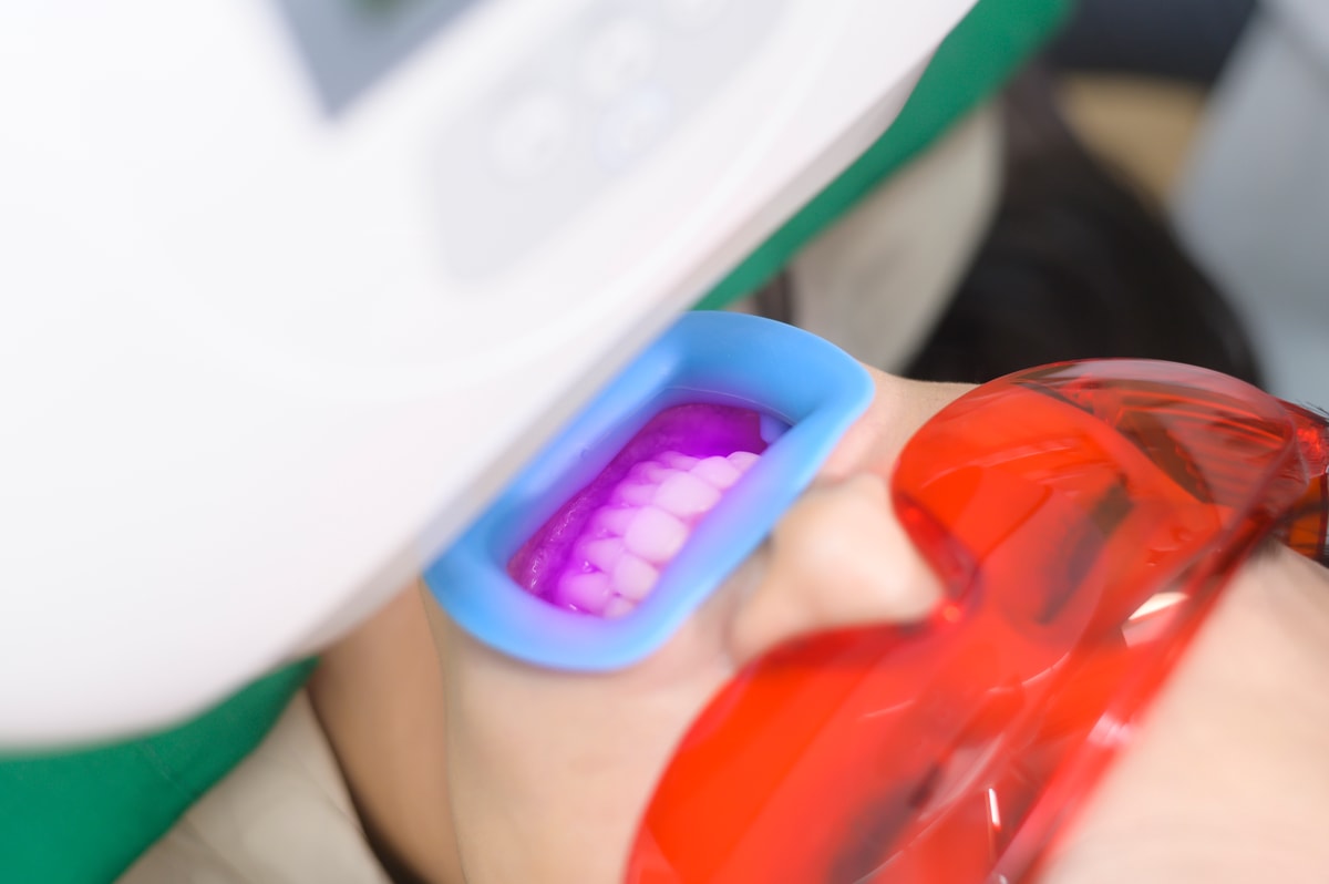 Teeth Bleaching